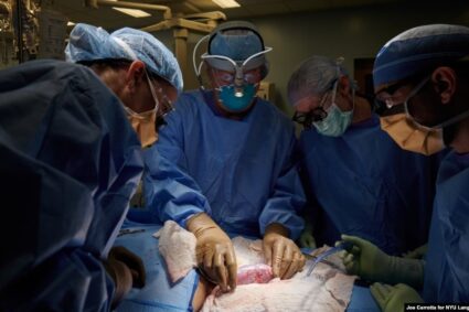 New York: « exploit médical, un rein de porc fonctionne sur un être humain pendant deux mois, un espoir pour la pénurie de dons d’organes »